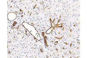 Immunohistochemistry analysis of paraffin-embedded human liver using AQP1 Polyclonal Antibody at dilution of 1:400. (Aquaporin 1 antibody)