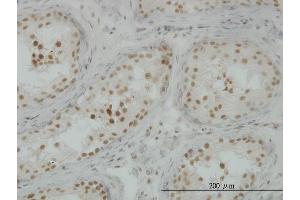 Immunoperoxidase of monoclonal antibody to CLK3 on formalin-fixed paraffin-embedded human testis.