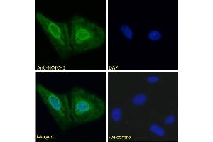 ABIN6391411 Immunofluorescence analysis of paraformaldehyde fixed U2OS cells, permeabilized with 0. (Notch1 antibody  (AA 171-182))