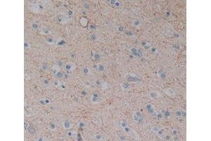 Used in DAB staining on fromalin fixed paraffin- embedded Kidney tissue (CPEB1 antibody  (AA 311-561))