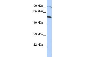 WB Suggested Anti-ZNF641 Antibody Titration:  0. (ZNF641 antibody  (Middle Region))