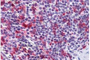 Human Spleen: Formalin-Fixed, Paraffin-Embedded (FFPE) (PCDH12 antibody  (N-Term))
