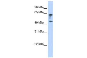 IGSF11 antibody used at 1 ug/ml to detect target protein.