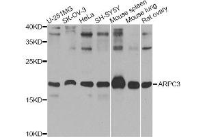 Western blot analysis of extracts of various cell lines, using ARPC3 Antibody (ABIN5974958) at 1/1000 dilution. (ARPC3 antibody)