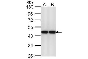 WB Image Sample (30 ug of whole cell lysate) A: Hep G2 , B: Molt-4 , 10% SDS PAGE antibody diluted at 1:1000 (Actin-Like 8 antibody)