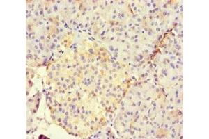 Immunohistochemistry of paraffin-embedded human pancreatic tissue using ABIN7165188 at dilution of 1:100 (RUNX1T1 antibody  (AA 416-525))