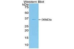 Western Blotting (WB) image for anti-V-Akt Murine Thymoma Viral Oncogene Homolog 2 (AKT2) (AA 142-412) antibody (ABIN1860233)