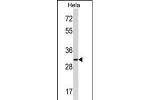 Western blot analysis of hRCKS- (ABIN389097 and ABIN2839288) in Hela cell line lysates (35 μg/lane). (MARCKS antibody  (C-Term))