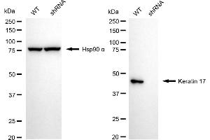 Western blotting analysis using Keratin 17 antibody (ABIN7799172).