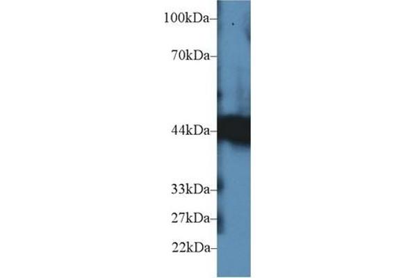 CPB1 antibody  (AA 111-417)