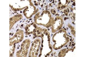 Immunohistochemistry of paraffin-embedded Human kidney using GPS1 Polyclonal Antibody at dilution of 1:100 (40x lens). (GPS1 antibody)