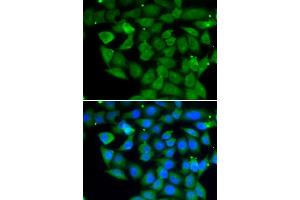 Immunofluorescence analysis of A549 cell using ELAC2 antibody. (ELAC2 antibody)
