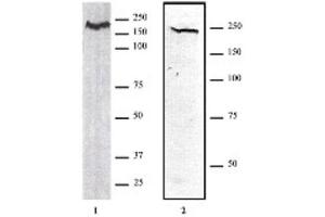 CHD1 antibody (pAb) tested by Western blot. (CHD1 antibody  (AA 251-467))