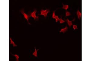 ABIN6274300 staining 293 by IF/ICC. (LMO4 antibody  (C-Term))