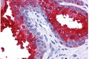 Human Prostate: Formalin-Fixed, Paraffin-Embedded (FFPE) (SCUBE2 antibody  (Internal Region))