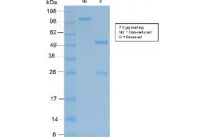 SDS-PAGE Analysis of Purified TRAcP Rabbit Recombinant Monoclonal Antibody (ACP5/2336R). (Recombinant ACP5 antibody)