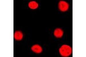 Immunofluorescent analysis of Estrogen Receptor 2 staining in HeLa cells. (ESR2 antibody  (Center))