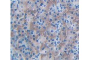 Figure. (CBR3 antibody  (AA 1-277))