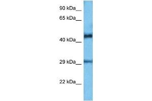 Host:  Mouse  Target Name:  ETV6  Sample Tissue:  Mouse Small Intestine  Antibody Dilution:  1ug/ml (ETV6 antibody  (C-Term))