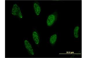 Immunofluorescence of monoclonal antibody to PPARA on HeLa cell. (PPARA antibody  (AA 1-258))