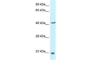 WB Suggested Anti-TPD52L2 Antibody Titration: 1. (TPD52L2 antibody  (C-Term))