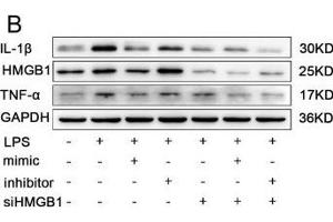 The effects of miR-339-5p and HMGB1-siRNA on LPS-induced RAW264. (IL-1 beta antibody  (AA 1-269))