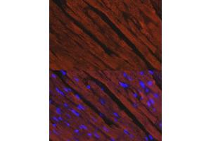 Immunofluorescence analysis of rat heart using MYH6/α-MHC antibody (ABIN6129610, ABIN6144236, ABIN6144237 and ABIN6216792) at dilution of 1:100. (MYH6 antibody  (AA 1-250))