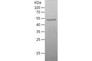 Western Blotting (WB) image for Solute Carrier Family 20 (Phosphate Transporter), Member 1 (SLC20A1) (AA 253-510) protein (His-IF2DI Tag) (ABIN7283833) (SLC20A1 Protein (AA 253-510) (His-IF2DI Tag))