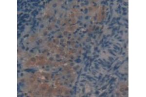 IHC-P analysis of Rat Tissue, with DAB staining. (LALBA antibody  (AA 20-159))