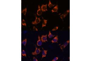 Immunofluorescence analysis of L929 cells using NDRG4 antibody  at dilution of 1:100. (NDRG4 antibody  (AA 140-220))