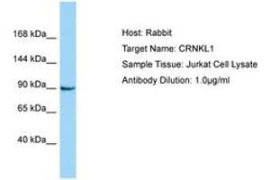 Image no. 1 for anti-Crooked Neck Pre-mRNA Splicing Factor-Like 1 (CRNKL1) (AA 760-809) antibody (ABIN6750173) (CRNKL1 antibody  (AA 760-809))