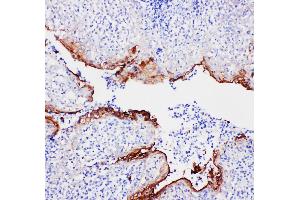 Anti-Annexin A1 antibody, IHC(P) IHC(P): Human Tonsil Tissue (Annexin a1 antibody  (N-Term))
