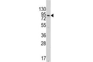 Western blot analysis of VE Cadherin antibody and 293 lysate. (Cadherin 5 antibody  (AA 106-134))