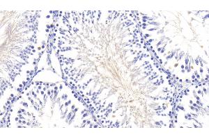Immunohistochemistry (IHC) image for anti-Lipopolysaccharide Binding Protein (LBP) (AA 226-480) antibody (ABIN7433612)