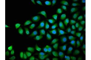 Immunofluorescence staining of Hela cells with ABIN7168754 at 1:66, counter-stained with DAPI. (DVL3 antibody  (AA 509-696))