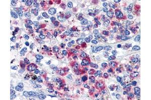 Immunohistochemistry staining of human spleen (paraffin sections) using anti-CD63 (TEM-259). (CD63 antibody)