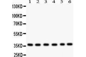 Anti- Rad51 Picoband antibody, Western blotting All lanes: Anti Rad51  at 0. (RAD51 antibody  (AA 1-258))