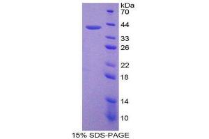 SDS-PAGE (SDS) image for Vitamin D-Binding Protein (GC) (AA 395-474) protein (His tag,GST tag) (ABIN2123748)