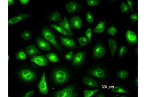 Immunofluorescence of monoclonal antibody to KRTHB1 on HeLa cell. (KRT81 antibody  (AA 1-202))