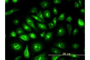 Immunofluorescence of monoclonal antibody to KRTHB1 on HeLa cell.