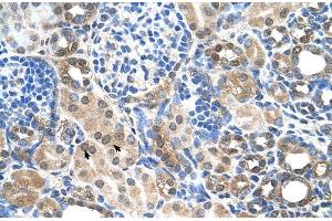 Human kidney (SLC22A7 antibody  (C-Term))