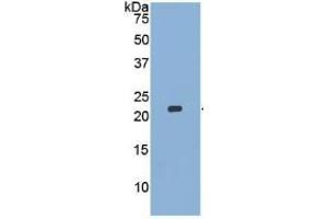 WB of Protein Standard: different control antibodies  against Highly purified E. (MMP13 ELISA Kit)