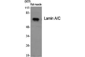 Western Blotting (WB) image for anti-Lamin A/C (LMNA) (Ser22) antibody (ABIN5957130) (Lamin A/C antibody  (Ser22))