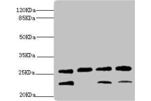Western blot All lanes: DR1 antibody at 2. (DR1 antibody  (AA 1-176))