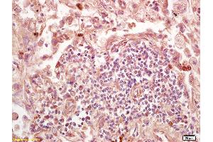 Formalin-fixed and paraffin embedded mouse embryo labeled with Rabbit Anti Lamin B Receptor Polyclonal Antibody, Unconjugated (ABIN709391) at 1:200 followed by conjugation to the secondary antibody and DAB staining (Lamin B Receptor antibody  (AA 1-100))