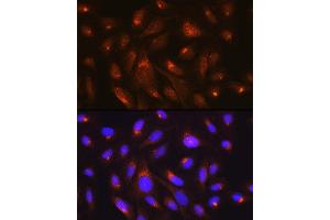 Immunofluorescence analysis of U-2 OS cells using RheB Rabbit mAb (ABIN7269863) at dilution of 1:100 (40x lens). (RHEB antibody)