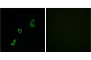 Immunofluorescence (IF) image for anti-Fibroblast Growth Factor 23 (FGF23) (AA 151-200) antibody (ABIN2889961) (FGF23 antibody  (AA 151-200))