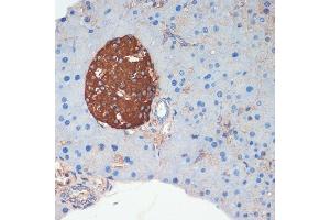 Immunohistochemistry of paraffin-embedded mouse pancreas using Somatostatin (SST) antibody (ABIN6133914, ABIN6148498, ABIN6148499 and ABIN6224956) at dilution of 1:200 (40x lens).