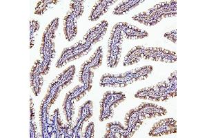IHC analysis of TXN2 using anti-TXN2 antibody (ABIN7602150). (TXN2 antibody  (AA 60-166))