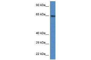 Western Blot showing ACSS2 antibody used at a concentration of 1 ug/ml against HT1080 Cell Lysate (ACSS2 antibody  (N-Term))